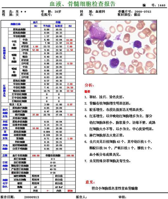 巨幼细胞性贫血怎么治疗才能好