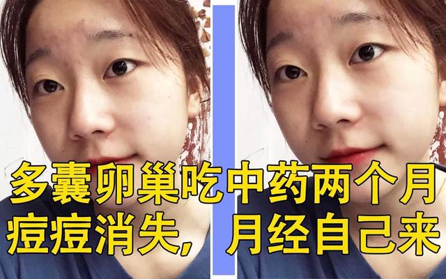 两个月以上的婴儿能吃中药吗