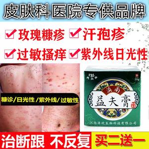 婴儿玫瑰疹怎么治疗