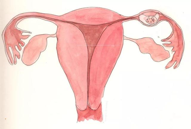 孕早期怎样辨别葡萄胎和双胞胎