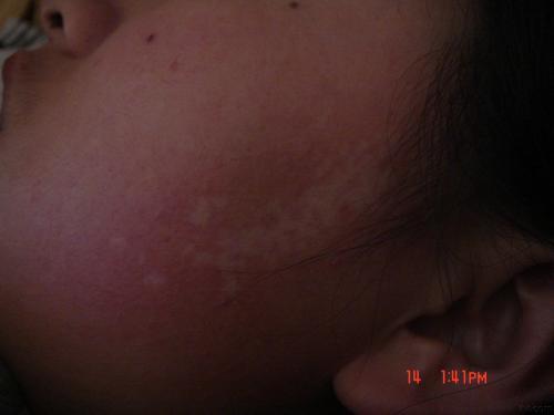 怎样知道孩子是不是贫血