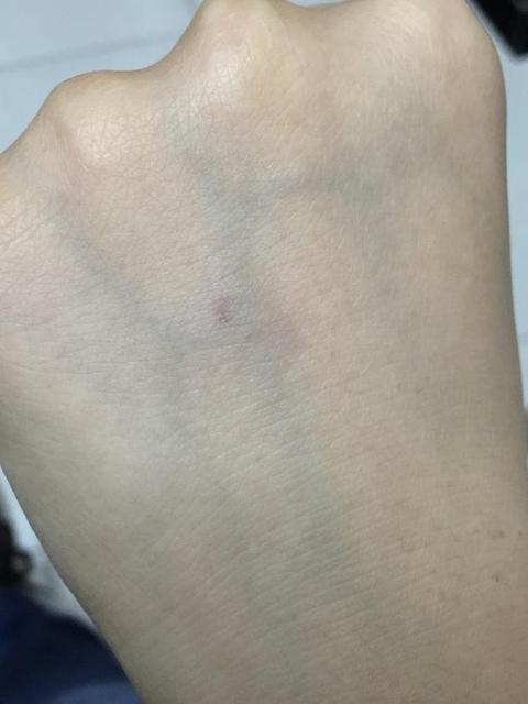 为什么孕妇血液容量会增加