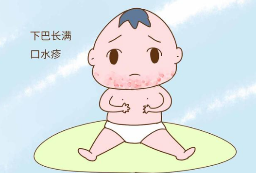 如何预防宝宝口水疹