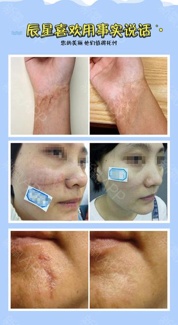 大连哪家医院去疤痕好的长尾关键词有什么