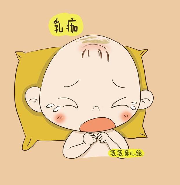 清洗新生儿乳痂