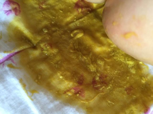 4个月的宝宝腹泻怎么办