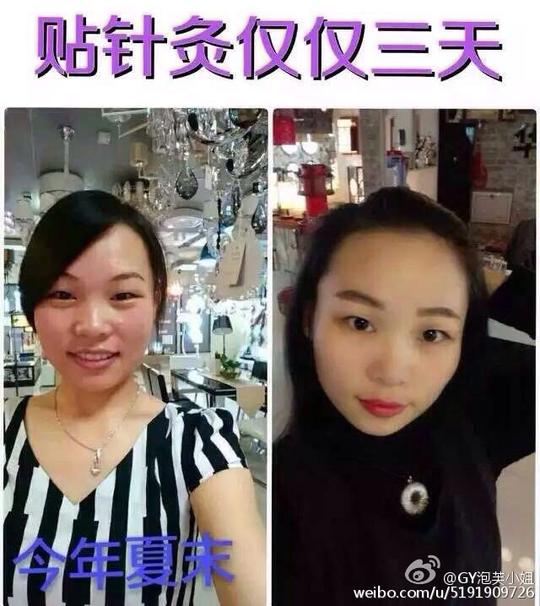 贴针灸丰胸微达人的相册详情微女郎,微博美女创业,微博美女,美女
