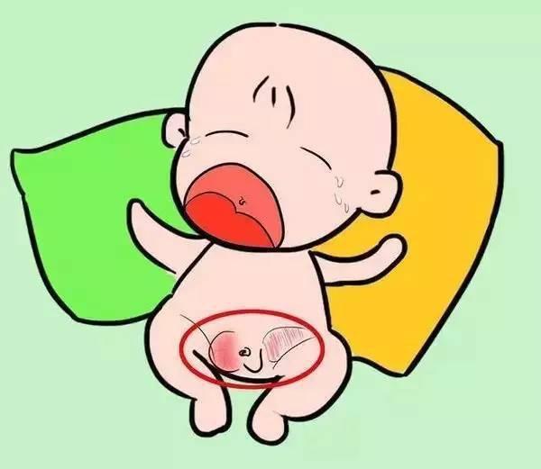 小儿疝气严重吗