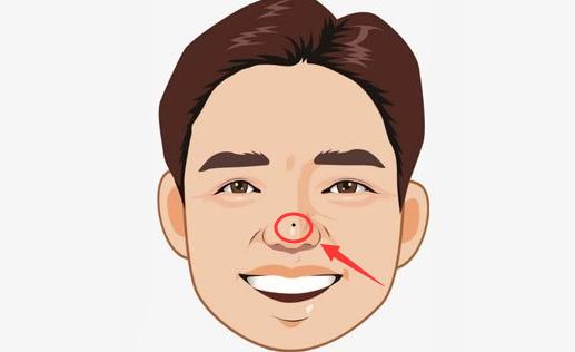 男人四颗发财痣，经商必赚，是做生意的材料!