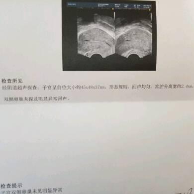 引产后恢复快