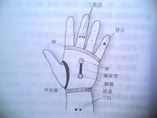 输尿管结石运动(第1页)