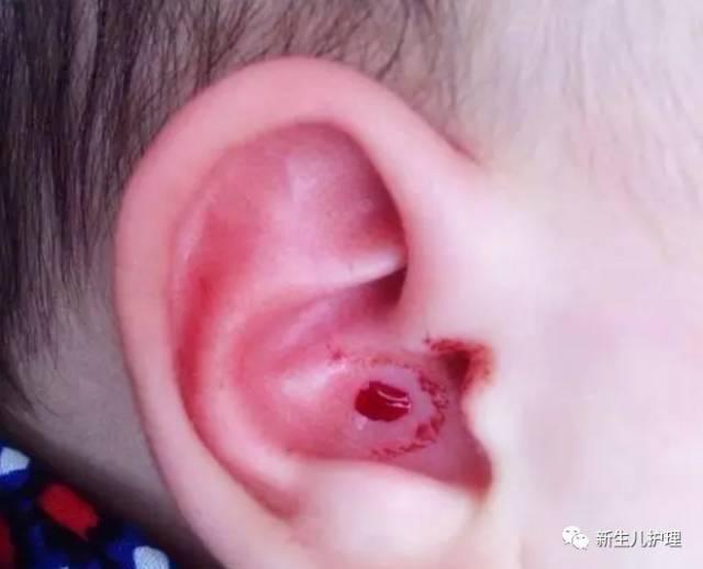 孩子总是反复生病什么原因