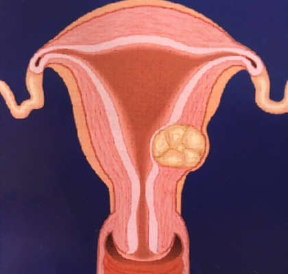 腹腔镜和宫腔镜有什么区别 输卵管