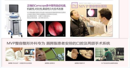 唇腭裂慈善手术,展开新的人生