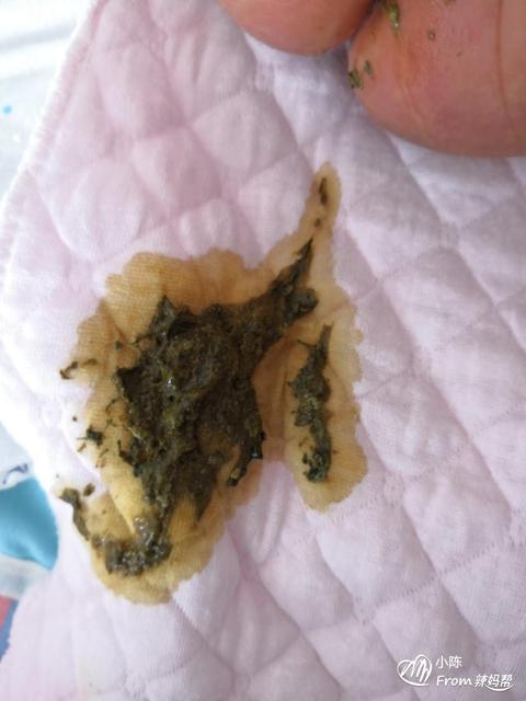 宝宝有黄疸要停母乳吗