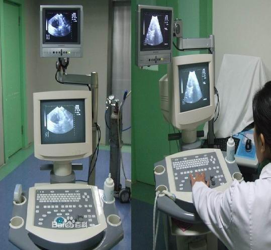 什么是微管可视人流