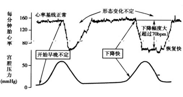 胎心监护有哪些异常情况