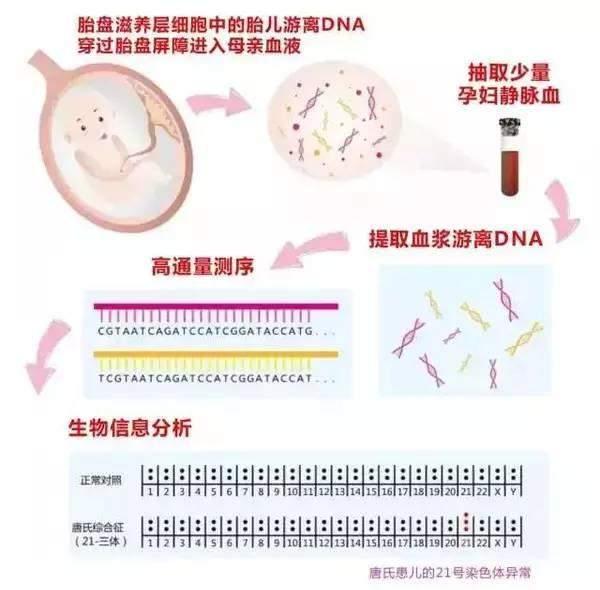 怀孕25周羊水偏多怎么办