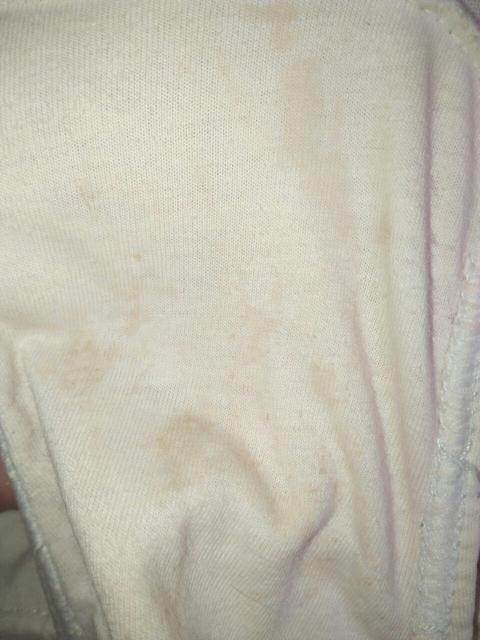 孕早期查出孕酮低怎么办