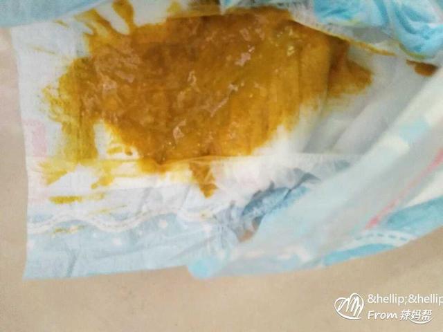 4个月的宝宝拉肚子怎么办