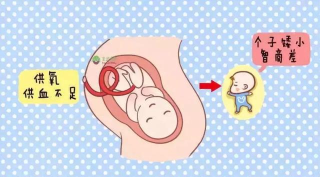 避免胎儿发育迟缓有哪些好的方法
