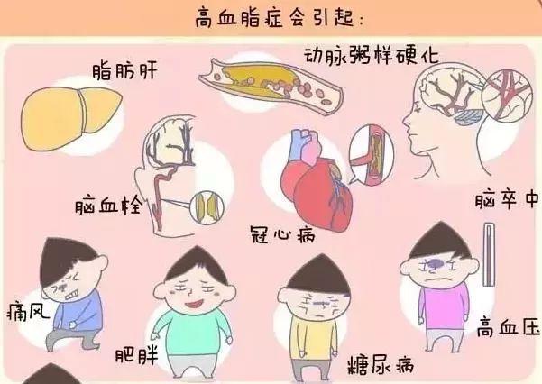 经常不喝水会引起血脂高吗