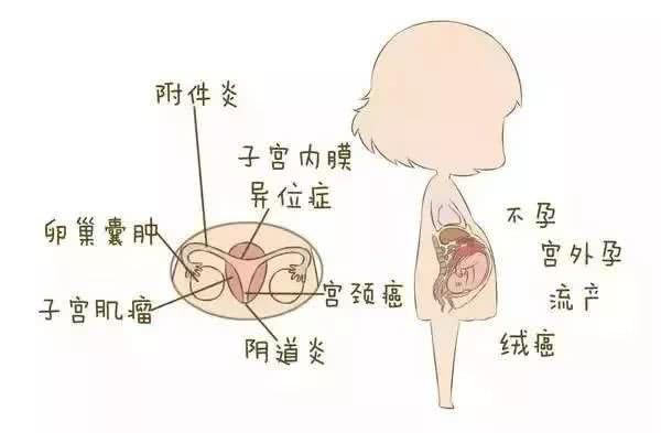 如何预防不孕