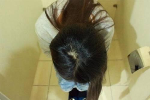 新生儿大便异常的7种情况