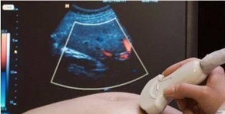 胎儿宫内缺氧的表现有哪些