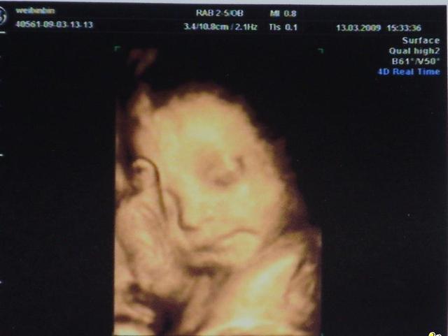 怀孕8个月胎儿b超图片