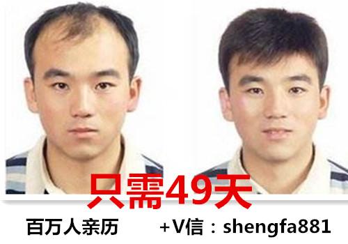维植真的有人用过吗,乌臣育发液效果怎么样呢?