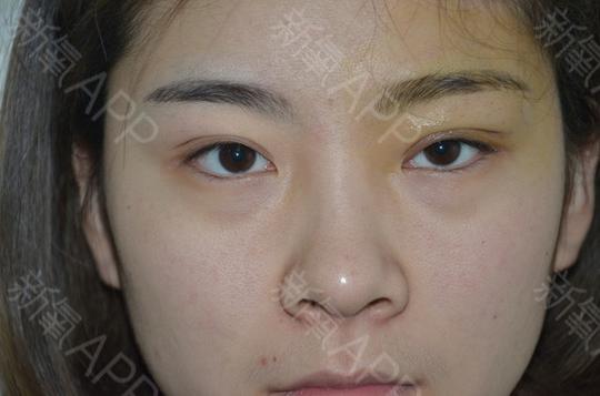 我的双眼皮不明显,左右眼还不一样大,一化眼妆基本上看不出有双