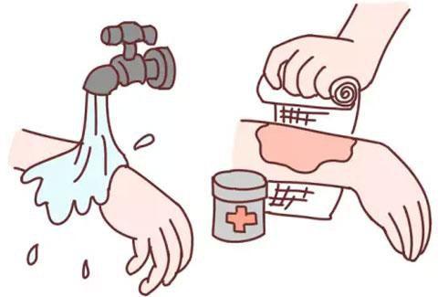 宝宝烫伤如何处理