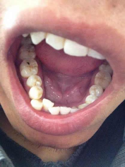 洗了牙齿牙齿会变白吗