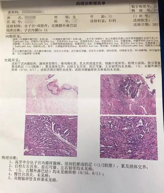 怀孕初期阴道出血的8疑问