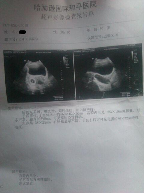 怀孕10周宝宝发育情况