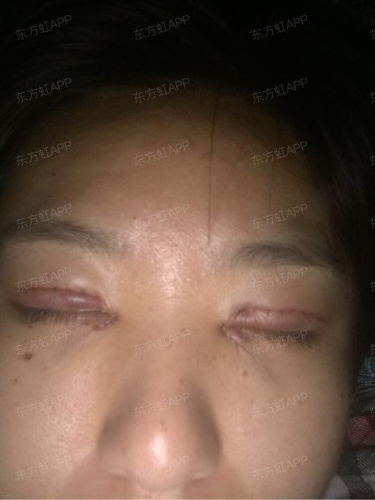 ps:三天没洗脸了,忽略我的油脸