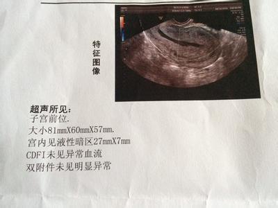 什么是子宫前位