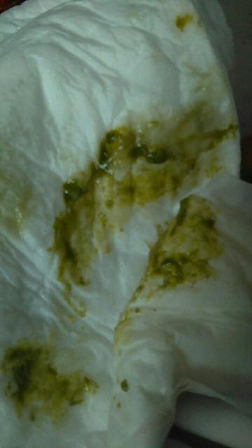 三岁宝宝腹泻拉水怎么办