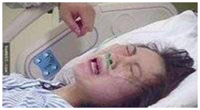 分娩麻醉的方式