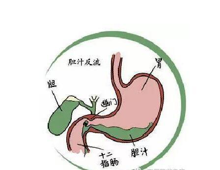 3岁宝宝急性肠胃炎可以喝奶粉吗