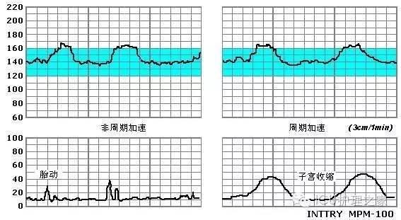 胎心监护的作用主要有哪些