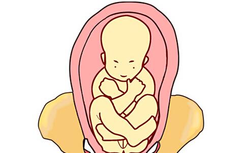 引起胎位不正的因素是什么