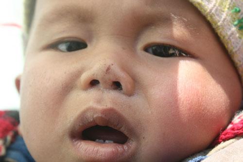 宝宝嘴唇干干的怎么办 宝宝嘴唇干干的怎么办