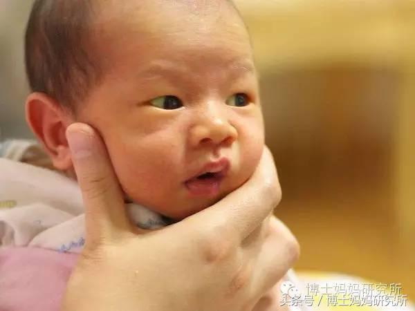 新生儿黄疸怎么治