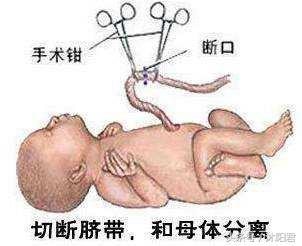 剪脐带宝宝会不会疼