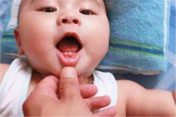 孩子出牙晚正常吗