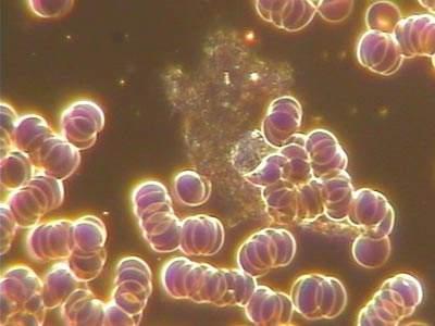 怀孕两个月肚子长绒毛怎么回事 怀孕两个月肚子长绒毛怎么回事