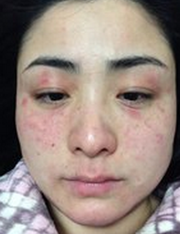 平时用什么温度的水洗脸对皮肤比较好