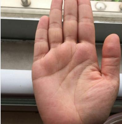 这种手相体质差，易生大病